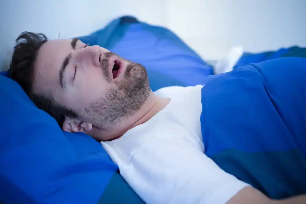 Man Sleeping with Sleep Apnoea
